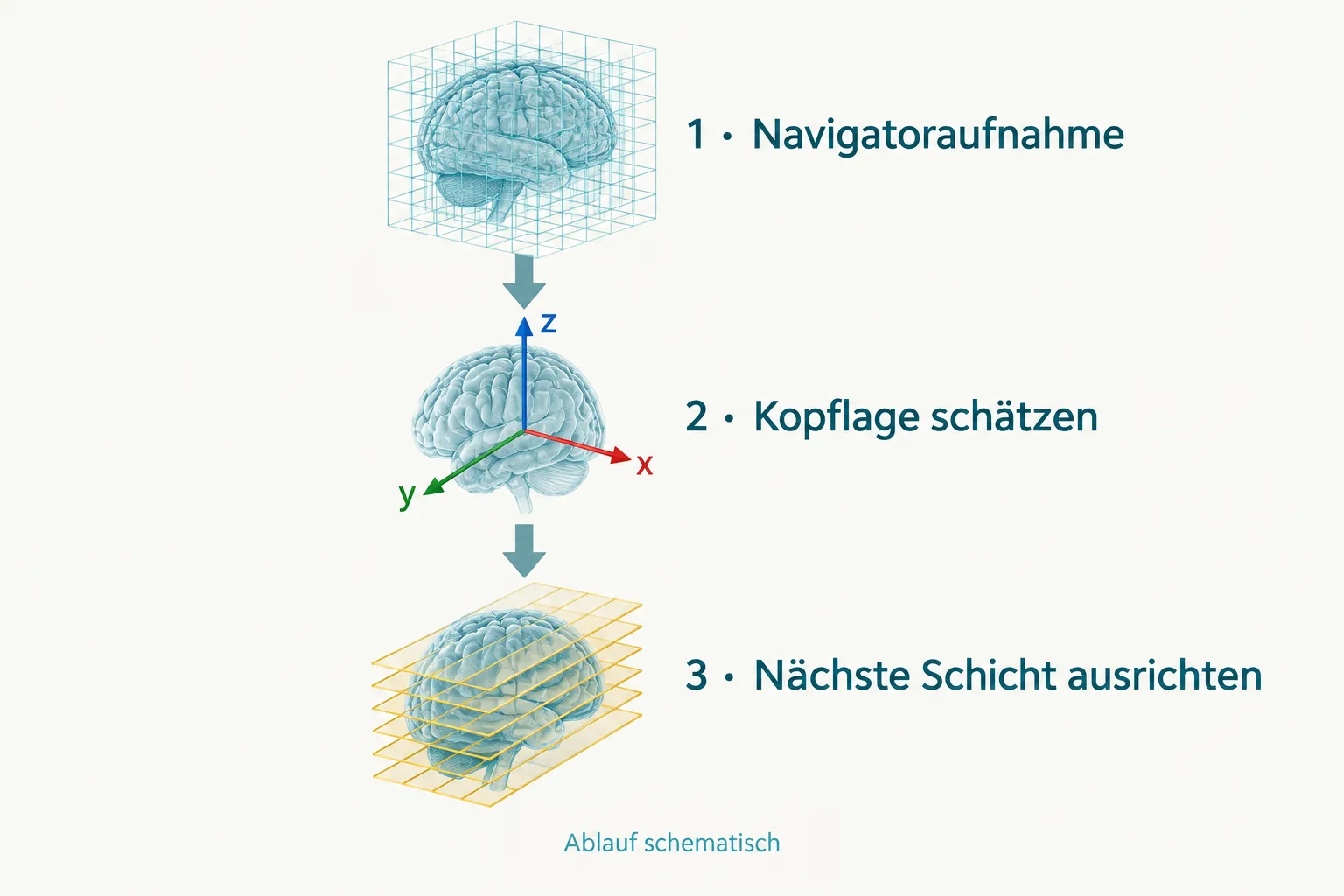 Drei schematische Schritte von der Navigatoraufnahme über die Kopflageschätzung zur ausgerichteten Schnittebene